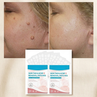 Skin Care Plasters For Moles And Warts