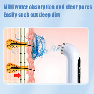 Rechargeable Pore Cleanser With 6 Interchangeable Heads And Adjustable Suction Power | Ashcroft