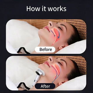 Sleep Device Smart Chin Clip Anti Snoring