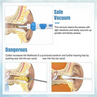Vacuum Ear Wax Remover With Soft Silicone Tips Gentle Vibration And Suction | Bellford
